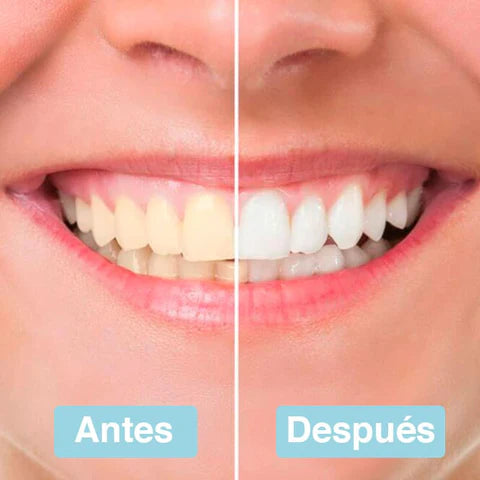 TIRAS BRANQUEADORAS DENTAIS - PEARLSHINE™