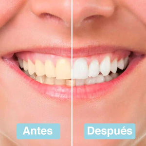 TIRAS BRANQUEADORAS DENTAIS - PEARLSHINE™