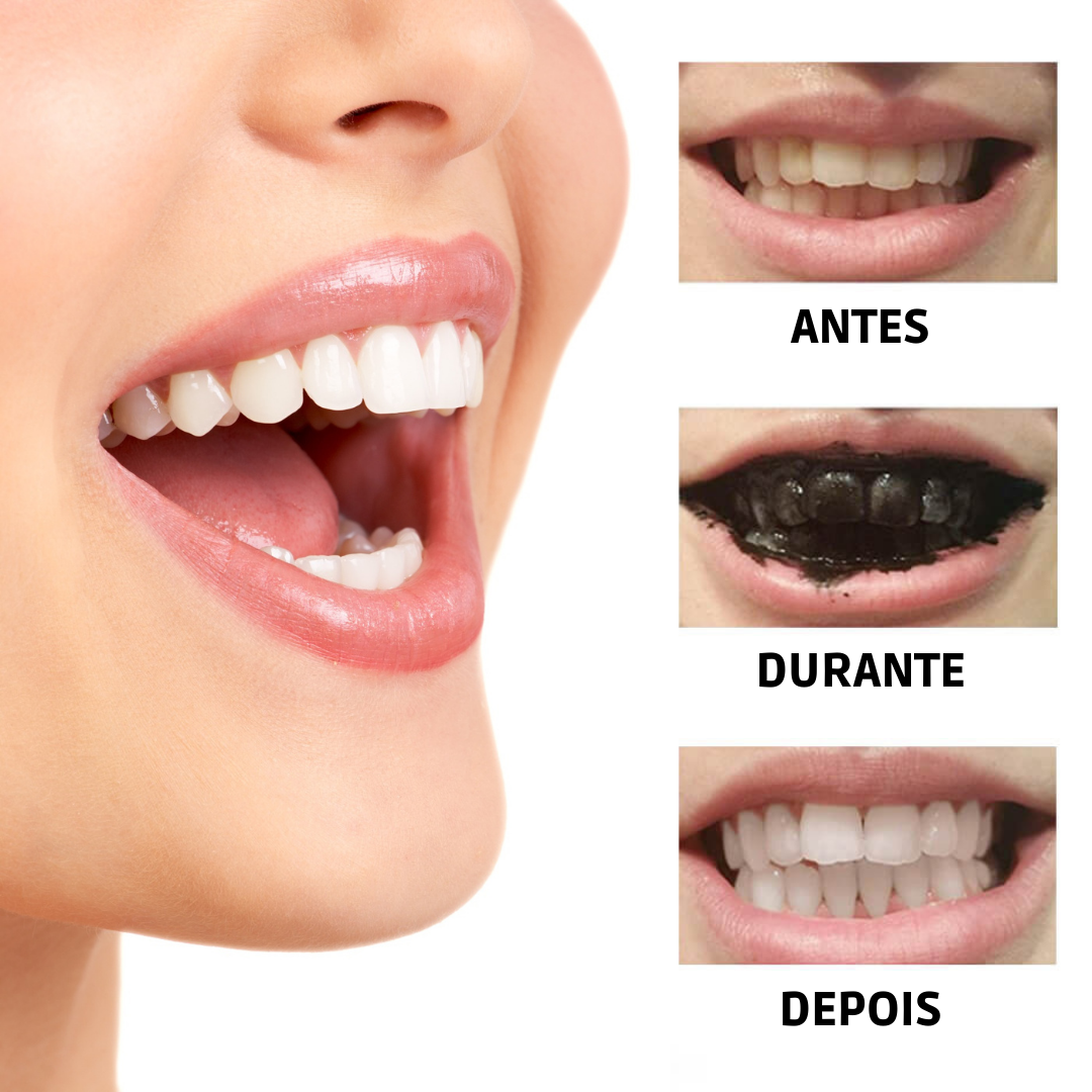 BRANQUEADOR DE DENTES COM CARVÃO ACTIVADO E EXTRACTO DE PLANTAS - WHITETH™