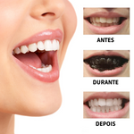 BRANQUEADOR DE DENTES COM CARVÃO ACTIVADO E EXTRACTO DE PLANTAS - WHITETH™